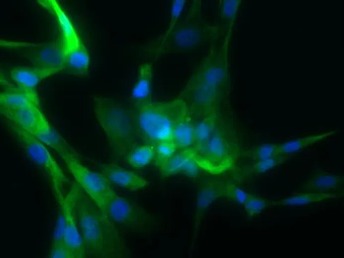 Human Aortic Smooth Muscle Cells (ACBRI 716)
