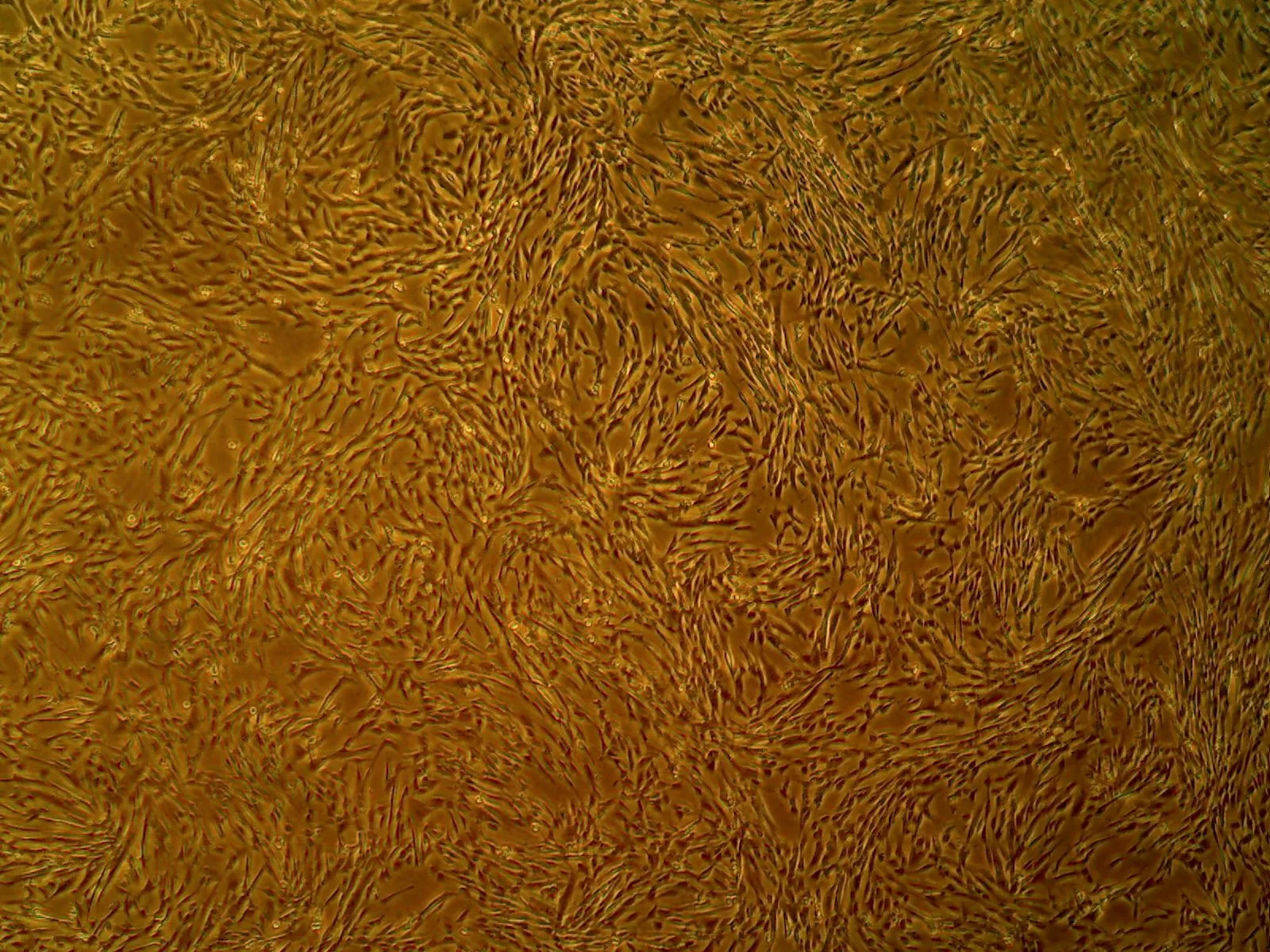 Human Aortic Smooth Muscle Cells (ACBRI 716)